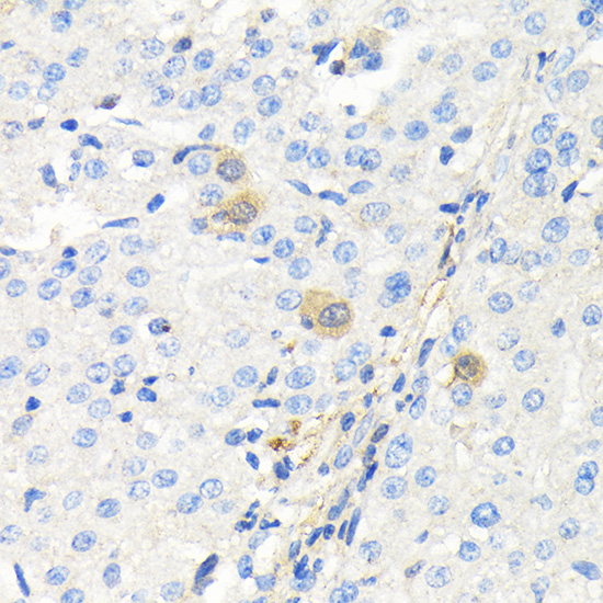 Thymidine Kinase 1 Rabbit polyclonal antibody