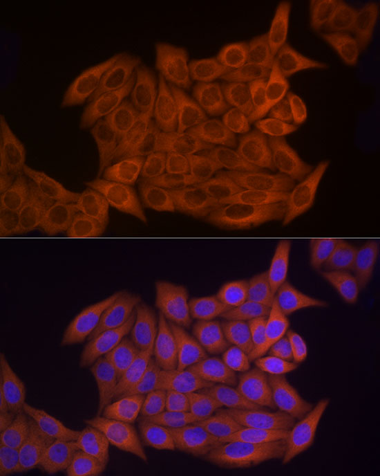 Thymidine Kinase 1 Rabbit polyclonal antibody