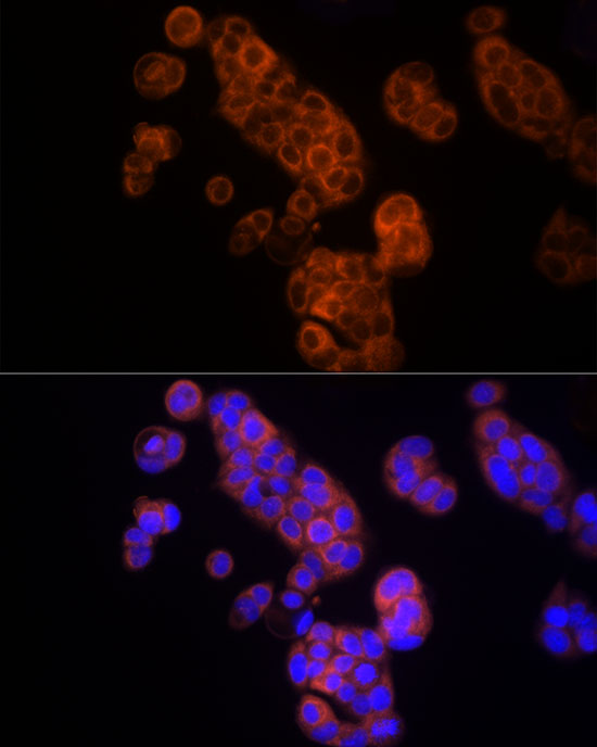 Thymidine Kinase 1 Rabbit polyclonal antibody