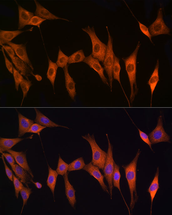 Thymidine Kinase 1 Rabbit polyclonal antibody