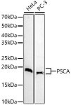Western blot - PSCA Rabbit pAb (A5614)