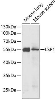 LSP1 Rabbit polyclonal antibody