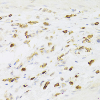 LSP1 Rabbit polyclonal antibody