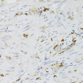 LSP1 Rabbit polyclonal antibody