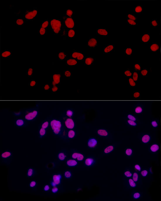 CREM Rabbit polyclonal antibody
