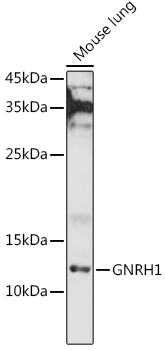 GNRH1 Rabbit polyclonal antibody