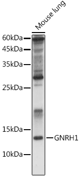 GNRH1 Rabbit polyclonal antibody