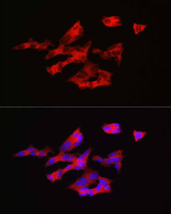 GNRH1 Rabbit polyclonal antibody