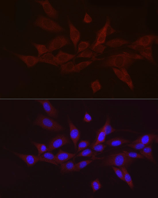 GNRH1 Rabbit polyclonal antibody