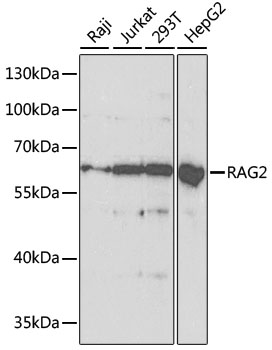 RAG2 Rabbit polyclonal antibody