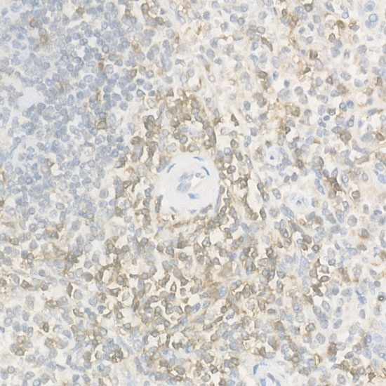 CD2 Rabbit polyclonal antibody