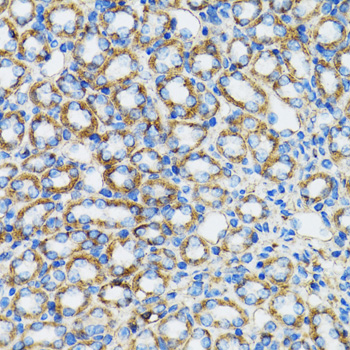[KO Validated] A Alpha-Catenin Rabbit polyclonal antibody