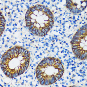 [KO Validated] A Alpha-Catenin Rabbit polyclonal antibody