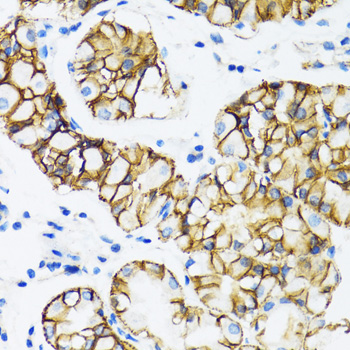 [KO Validated] A Alpha-Catenin Rabbit polyclonal antibody