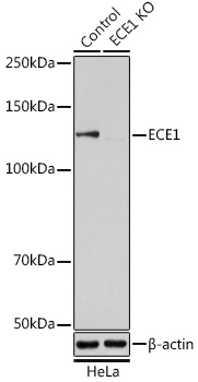 [KO Validated] ECE1 Rabbit polyclonal antibody