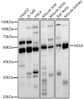 HEXA Rabbit polyclonal antibody