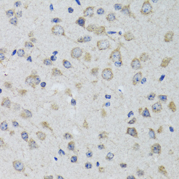 HTR3A Rabbit polyclonal antibody