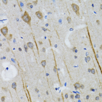 HTR3A Rabbit polyclonal antibody