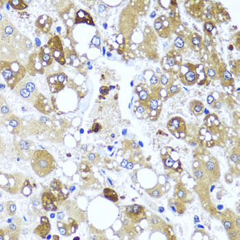 IL4 Rabbit polyclonal antibody