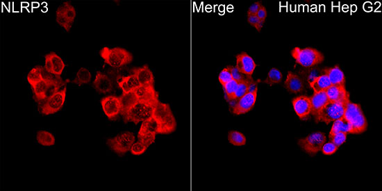 NLRP3 Rabbit polyclonal antibody
