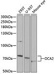 Western blot - OCA2 Rabbit pAb (A5653)