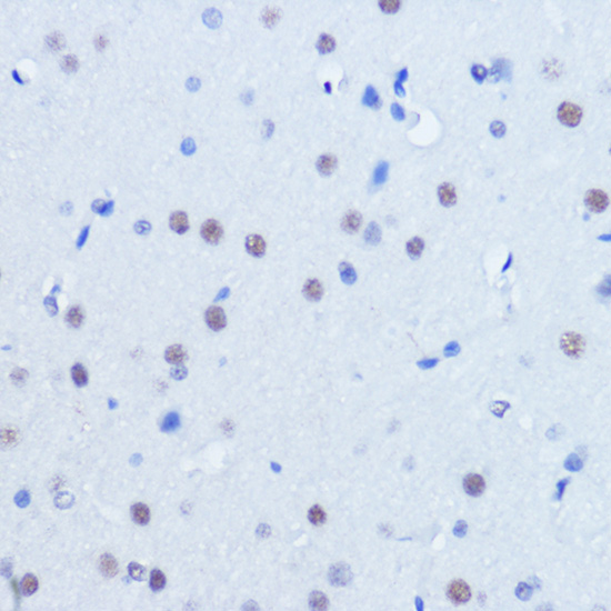 PIAS2 Rabbit polyclonal antibody