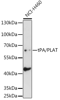 tPA/PLAT Rabbit pAb