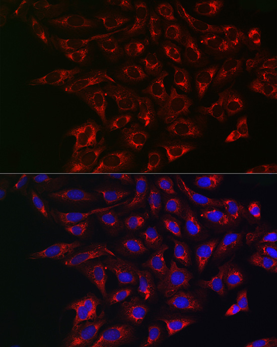 ABCG2 Rabbit polyclonal antibody
