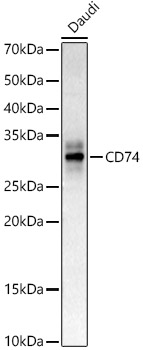CD74 Rabbit polyclonal antibody