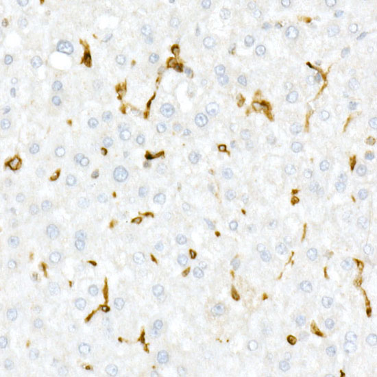 CD74 Rabbit polyclonal antibody