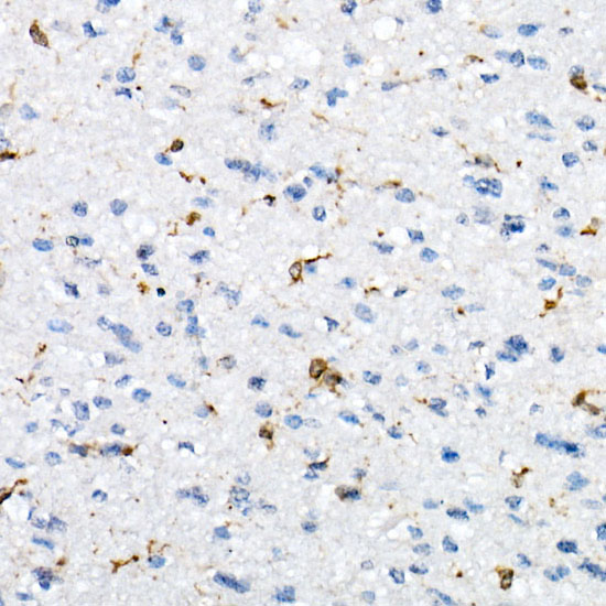 CD74 Rabbit polyclonal antibody