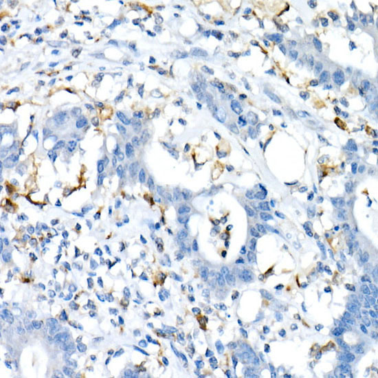 CD74 Rabbit polyclonal antibody