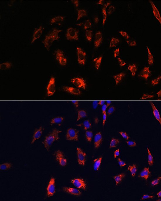 CD74 Rabbit polyclonal antibody