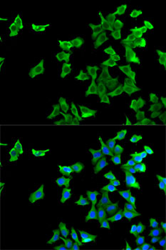 HTR2B Rabbit polyclonal antibody