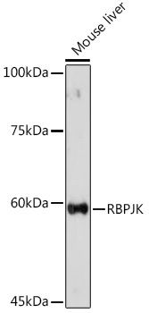 RBPJK Rabbit polyclonal antibody
