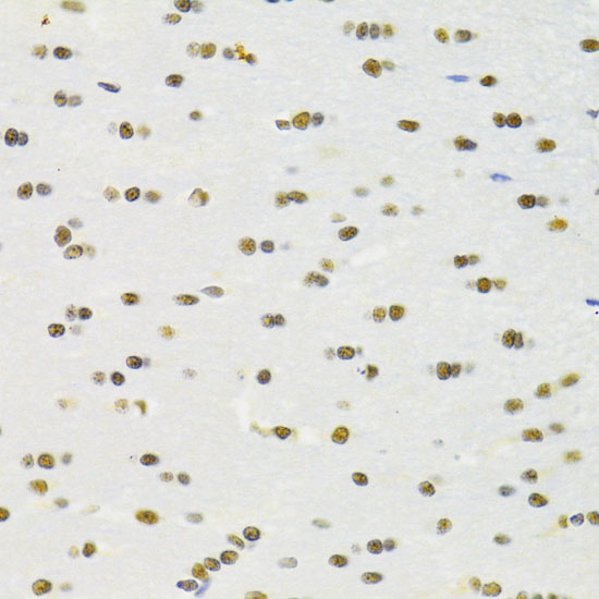 RBPJK Rabbit polyclonal antibody