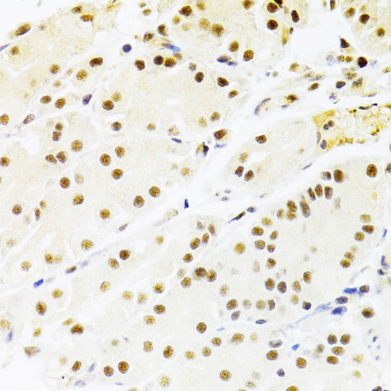 RBPJK Rabbit polyclonal antibody