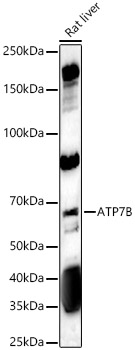 ATP7B Rabbit polyclonal antibody