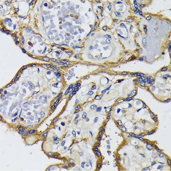 IQGAP1 Rabbit polyclonal antibody