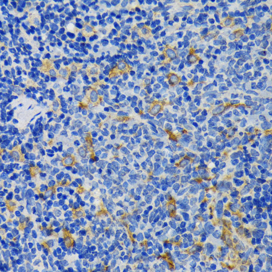 IQGAP1 Rabbit polyclonal antibody