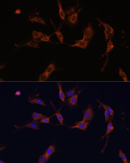 IQGAP1 Rabbit polyclonal antibody