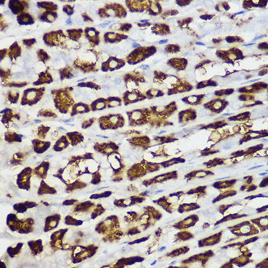 BNIP3 Rabbit polyclonal antibody