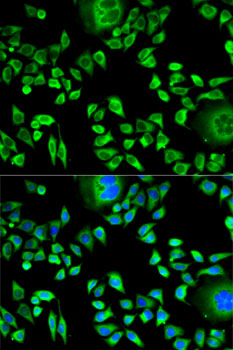 CSTA Rabbit polyclonal antibody