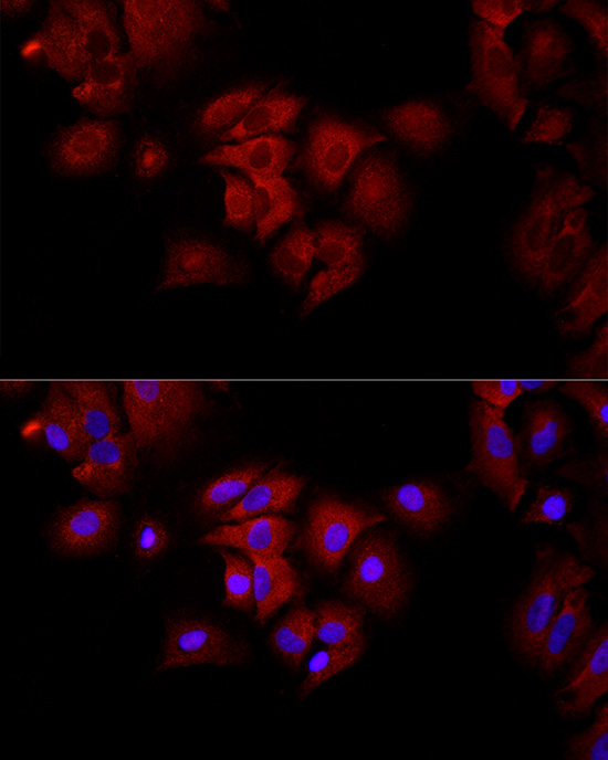 FH Rabbit polyclonal antibody
