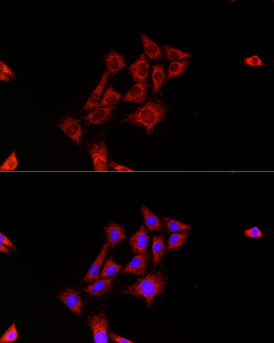 FH Rabbit polyclonal antibody