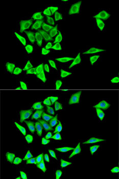 GRB2 Rabbit polyclonal antibody