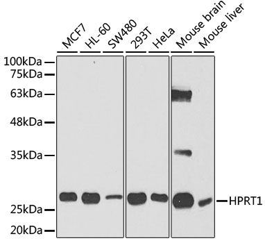 [KO Validated] HPRT1 Rabbit polyclonal antibody