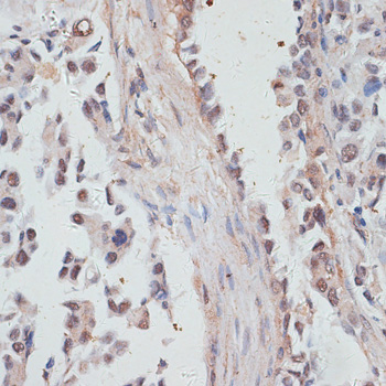 NCOA4 Rabbit polyclonal antibody