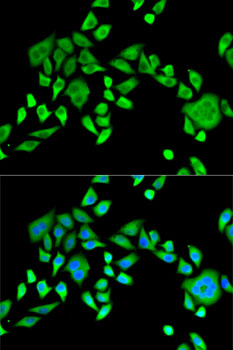 SH3GL2 Rabbit polyclonal antibody
