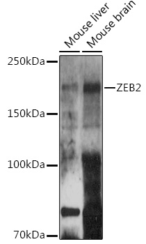 ZEB2 Rabbit polyclonal antibody